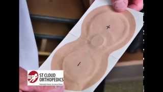 St Cloud Orthopedics  Iontophoresis Medicine Patch [upl. by Nicolais]