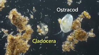 Cladocera Chydoridae with eggs and babies plus size compared to Ostracods [upl. by Carleton774]