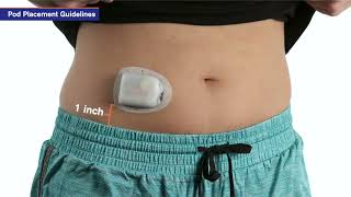 Insulin Pump Training Omnipod DASH®  How to remove a Pod [upl. by Neros728]