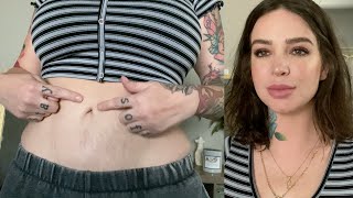 Tummy Tuck tips  Swelling Best Faja My advice  Still Glamorus [upl. by Ashti]