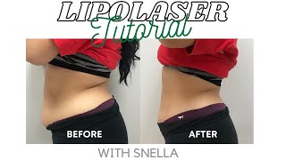 Lipolaser Tutorial  How To Use Lipolaser  Snella Body Contouring Lipolaser [upl. by Llirret]