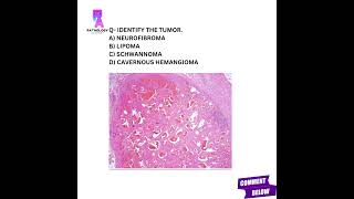 Histopathology questions histopathology mbbs md pathologyacademy draditikumar [upl. by Ihn153]