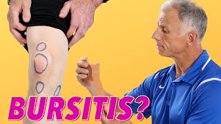 What Is Causing Your Knee Pain Bursitis How To Tell [upl. by Jeroma615]