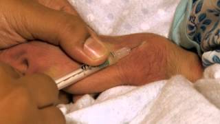 Giving an Intradermal Injection Swahili  Newborn Care Series [upl. by Akimyt721]