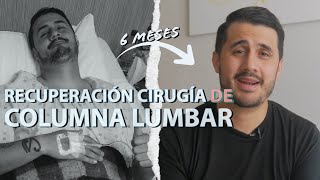 3 Ejercicios MALOS Para Hernia de Disco Lumbar Y Ciatica [upl. by Bergin]