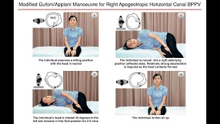 Modified GufoniAppiani Manoeuvre for Right Apogeotropic Horizontal Canal BPPV [upl. by Charmain995]