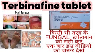 Terbinafoce Tablet use Hindi  Terbinafine Tablet IP 250mg  antifungals tablet  Tarbinafoce tablet [upl. by Lacey719]