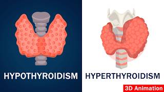 Hypothyroidism vs Hyperthyroidism Explained thyroid [upl. by Aek195]