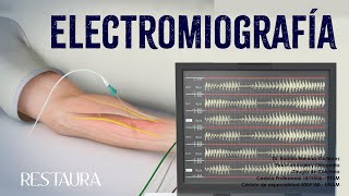 ¿Qué es la electromiografía [upl. by Aihseyk]