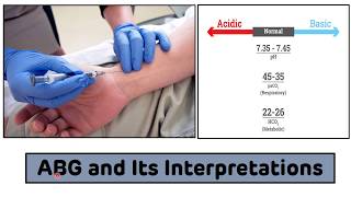 Arterial Blood Gas ABG Analysis  Arterial Blood Gas ABG Interpretations In 3 Easy Steps [upl. by Trella]