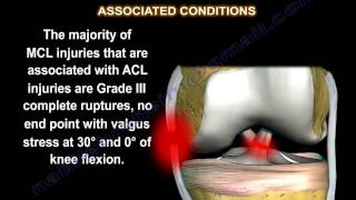 Medial Collateral Ligament injury  MCL Injuries  Everything You Need To Know  Dr Nabil Ebraheim [upl. by Luhey511]