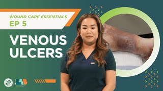 Wound Care Essentials Video 5 – Venous Ulcers [upl. by Philcox]