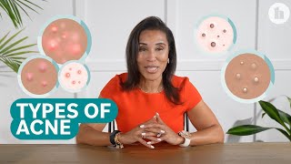 The Different Types of Acne and How to Treat Them [upl. by Berlin330]