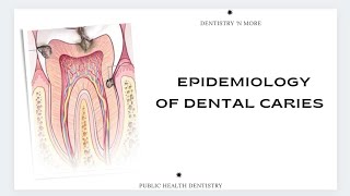 EPIDEMIOLOGY OF DENTAL CARIES [upl. by Adelheid]