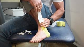 Peroneal Subluxation Test Video Demonstration [upl. by Peri]