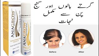 Hair Growth  Anagrow Hair Growth Serum Honest Review  Get Smooth Shiny Hair [upl. by Jecoa]