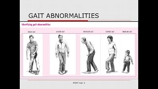 Types of Gait Abnormalities  Antalgic Ataxic Shuffling Steppage Waddling Festinating Scissors [upl. by Iclehc]