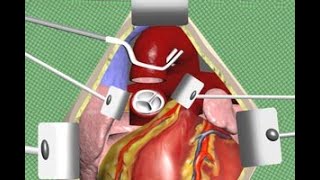 Left Ventricle Heart  Function Definition and Anatomy Human Anatomy  Kenhub [upl. by Romie856]