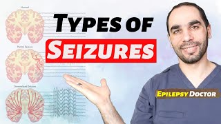 How to help if someone has a tonic clonic seizure  Epilepsy Action Employer Toolkit [upl. by Klinges715]