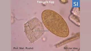 Fasciola egg [upl. by Hsetirp290]