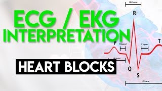 Heart Blocks Made Easy  ECG EKG Interpretation Part 6 [upl. by Caldeira]