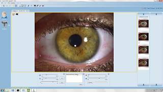 Capturing Images  EyeSuite Software [upl. by Ynotna798]