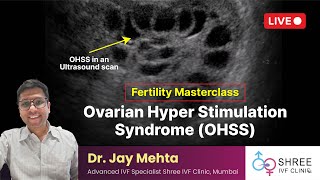 Fertility Masterclass 37  Ovarian Hyper Stimulation Syndrome OHSS  Manegement of OHSS [upl. by Lledner752]