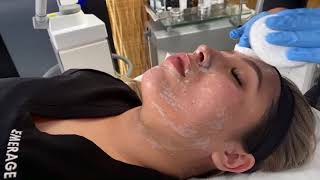 BEST EXTRACTION FACIAL FOR WHITEHEADS AND BLACKHEADS  DIAMOND TIP DERMALINFUSION  Dr Jason Emer [upl. by Gavette972]