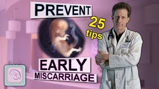 Early miscarriage  25 things to know when trying to conceive [upl. by Merissa]