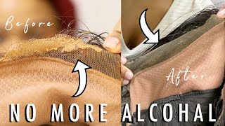 HOW TO Safely REMOVE GLUE off your lace wig AND SKIN  EASY amp QUICK amp SAFE [upl. by Perr]