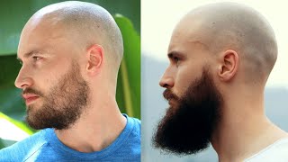 Thin Beard To Winning Beard And Back My Entire Beard Journey [upl. by Daitzman]