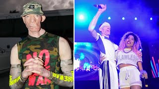 Yellowman  8 Facts You Might Never Know About Yellowman [upl. by Eicirtap]