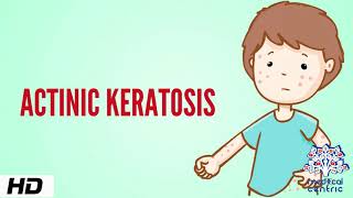 Actinic keratosis [upl. by Sillad]