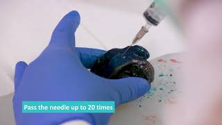 Fresh Tissue Sampling  Fine Needle Aspirate FNA Technique [upl. by Mulford739]