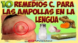 10 Remedios Caseros para las Ampollas en la Lengua [upl. by Nipsirc]