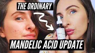 The Ordinary Mandelic Acid 10 HA 2 MONTH UPDATE [upl. by Auqinom714]