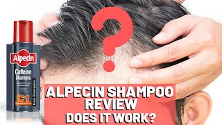 Alpecin Shampoo Review  Do We Recommend It [upl. by Nagey]