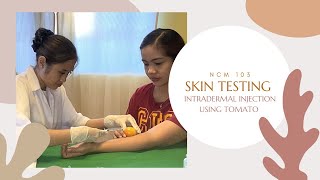 Intradermal InjectionSkin testing using Tomato [upl. by Akenaj]