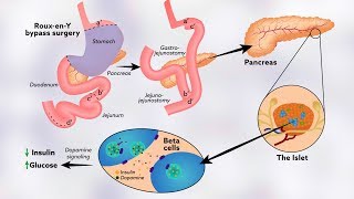 How tyrosine might help regulate glucose levels [upl. by Welford]