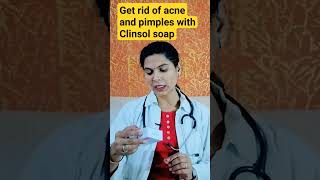 Get rid of acne and pimples with Clinsol soap shorts [upl. by Attenwahs752]