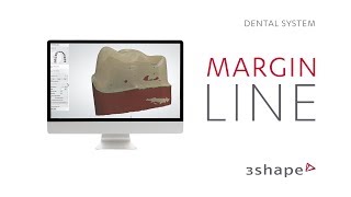 3Shape Dental System  Margin line [upl. by Samaj]