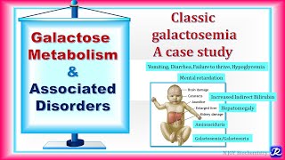 22 Galactose metabolism amp Associated Disorders  carbohydrates Metabolism  Biochemistry [upl. by Nytsirhc]