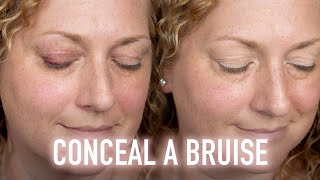 How To Properly Color Correct And Conceal A Bruise And Make It Undetectable [upl. by Aselehc10]