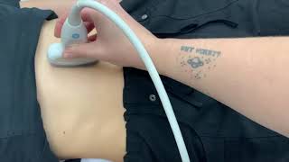 Preoperative Gastric Ultrasound Examination [upl. by Dana]