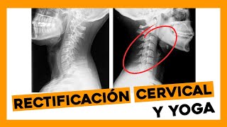 Rectificación cervical y yoga [upl. by Varden]