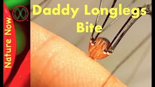 Daddy Long Legs  Myth or Legend [upl. by Ellehcal]