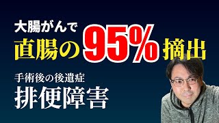 大腸がんで直腸の95％を摘出 手術後の後遺症【排便障害】 [upl. by Gonroff895]