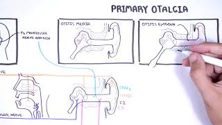 Understanding Ear Pain  Otalgia Innervation of ear mechanism of ear pain and causes [upl. by Ahsircal]