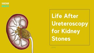 Lithotripsy Procedure for Kidney Stones Removal Experience  Robert Titus [upl. by Aerbas]