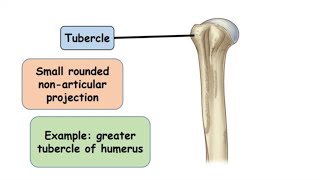 Tubercle Bone Marking [upl. by Aimaj]